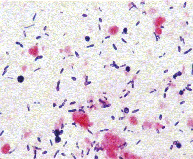 Figure 15-10