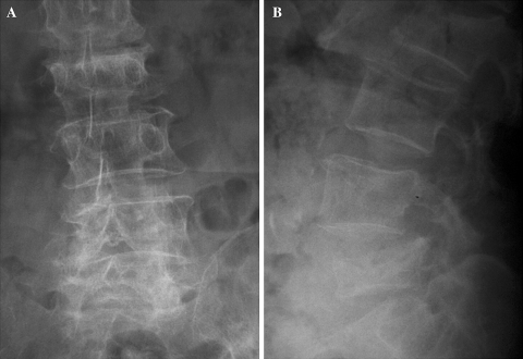 Fig. 1