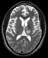 Fig 1.