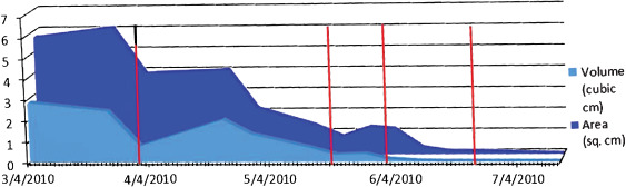 Figure 11