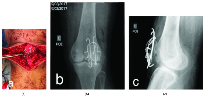 Figure 7