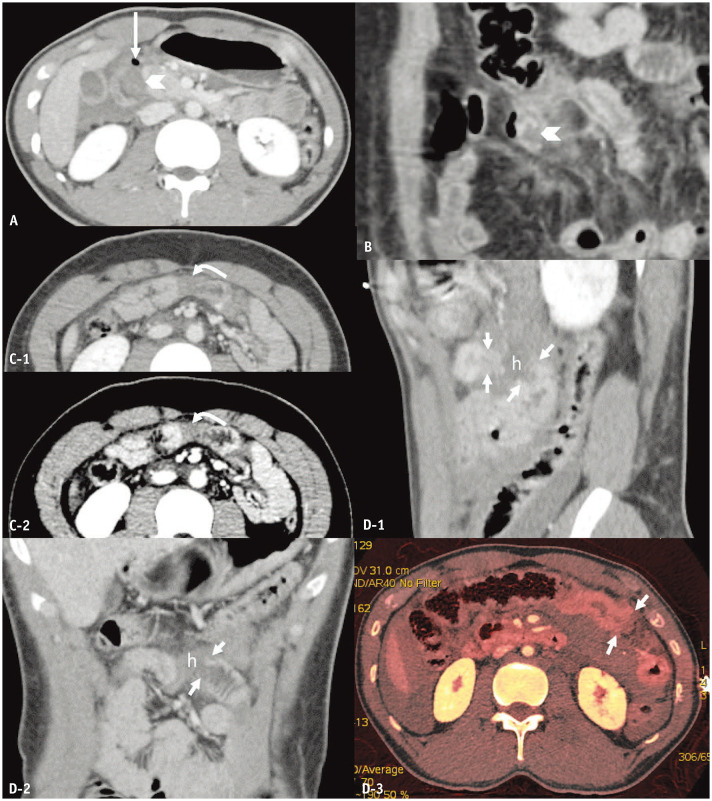 Fig. 2