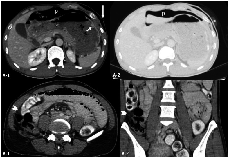 Fig. 6