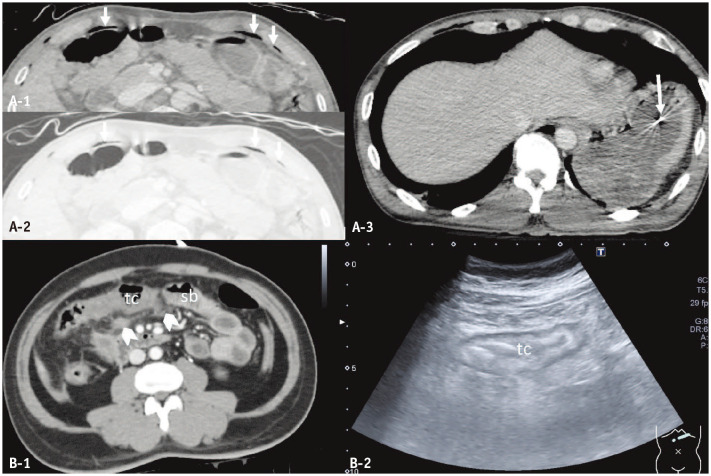 Fig. 10