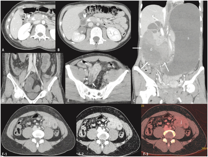 Fig. 4