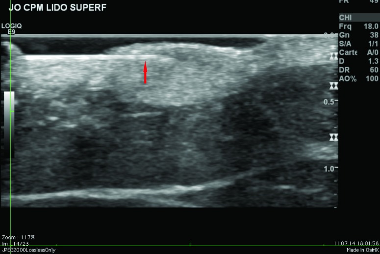 Figure 2.