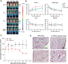 Figure 5. TROP-2 is an Effective Target for PET imaging and treatment of xenograft mCRPC tumors. (A) Serial PET imaging and ROI quantifications of TROP-2 in LAPC4, PC3, and 22rv1 tumor-bearing mice injected with 64Cu-labeled anti–TROP-2 antibody or non-specific IgG control as indicated at 4, 24, and 48 hours after injection. H-Heart, L-Liver, and T-Tumor. (B) Time–activity curves of the tumor, liver, blood, and muscle upon intravenous injection of 64Cu-labeled anti–TROP-2 antibody into LAPC4, PC3 or 22rv1 tumor-bearing mice (n = 3). (C) Treatment of LAPC4 xenograft tumors with 90Y-labeled TROP-2 or IgG. Tumor growth is measured as the percentage of initial tumor volume (n = 3). The primary endpoint of the study was pre-specified at 12 days, when all mice were sacrificed, and the time at which we would expect maximal treatment effect. Statistical inference was performed at the primary endpoint, where a Student t test was performed. *, p < 0.05 and was considered statistically significant. (D) H&E staining shows increased cell death in 90Y-labeled TROP-2 sample compared with the control PBS treatment.