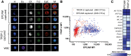 Figure 4. CTCs are heterogeneous with respect to EPCAM and TROP-2 expression in a patient with NEPC. (A) CTCs were captured with EPCAM and TROP-2 antibodies in parallel and were identified positive for Hoechst (H) and pan-cytokeratin (CK) and negative for exclusion marker cocktail (Ex). Cells were also stained for EPCAM (EpC) and TROP-2 (Tr2); scale bar, 5 μm. (B) The mean fluorescent intensities (MFI) of TROP-2 versus EPCAM were graphed for each CTC identified after capture with antibodies to either TROP-2 (red) or EPCAM (blue) and plotted as individual cells. (C) Gene expression analysis of EPCAM captured and TROP-2–captured populations of cells shows expression of neuroendocrine genes and genes downstream of AR.