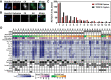 Figure 3. Analysis of TROP-2 Captured CTCs. CTCs were captured from patients with metastatic prostate cancer using the indicated antibody. Images of representative CTCs are shown for CTCs captured using antibodies to (A) EPCAM and (B) TROP-2. CTCs are stained with Hoechst (Blue), AR (Green), CD45/CD11B/CD14 (Exclusion, Red) and Pan-Cytokeratin (CK, White; scale bars, 5 μm). (C) Enumeration of CTCs from 15 patients with metastatic prostate cancer captured by the indicated antibody is shown. (D) Gene expression analysis of EPCAM-captured and TROP-2-captured (T) CTCs from 40 patients with prostate cancer.