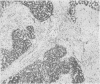 238
