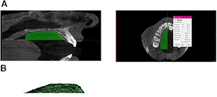 Figure 2