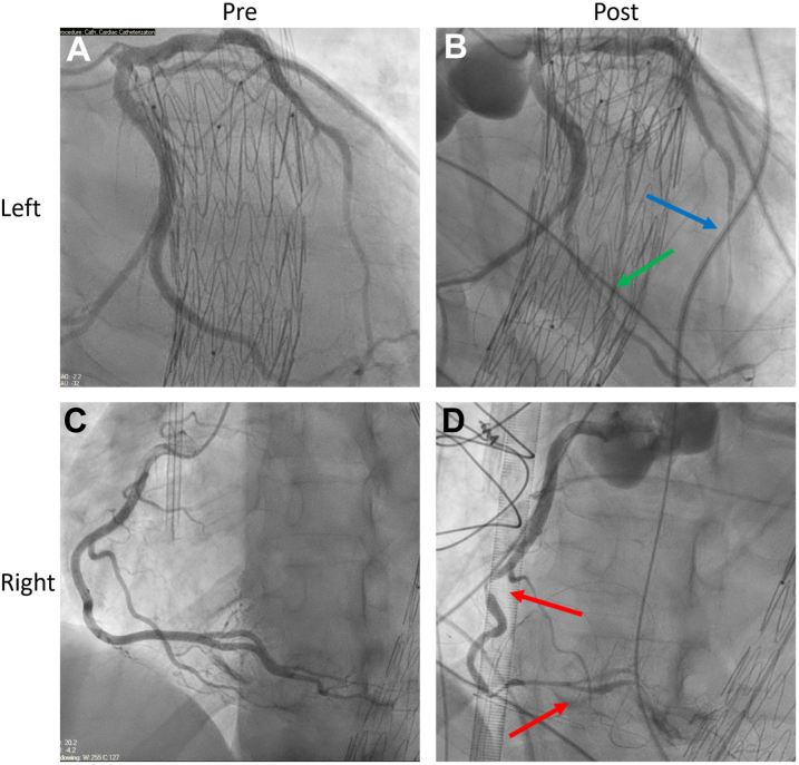 Figure 2