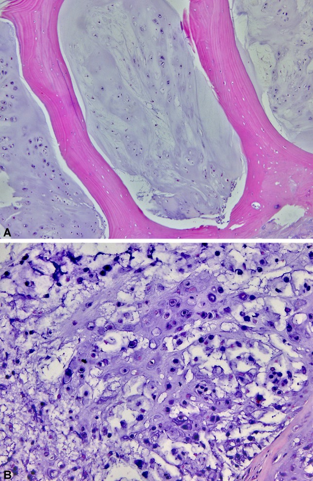 Fig. 1A–B