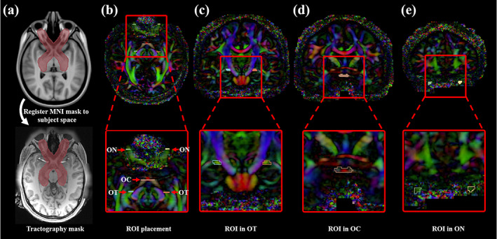 FIGURE 3