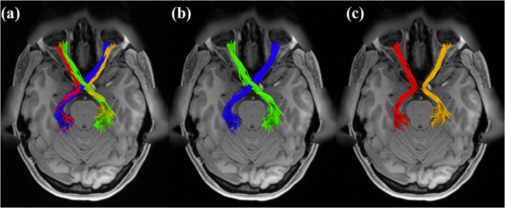 FIGURE 4