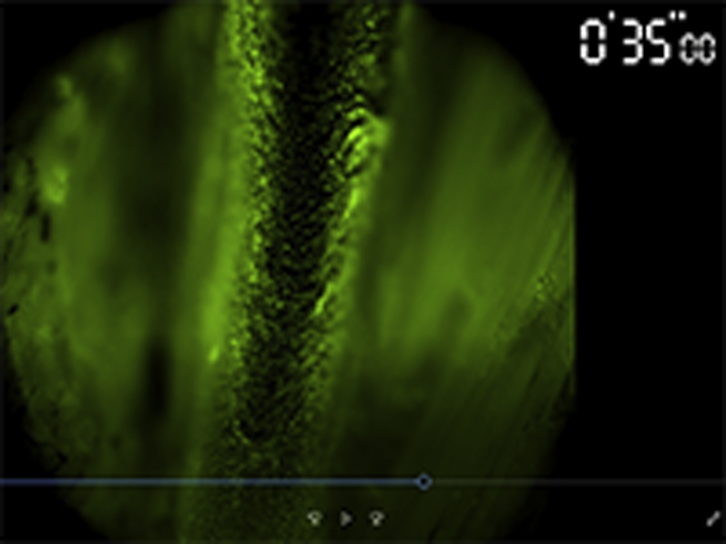 graphic file with name grv1.jpg