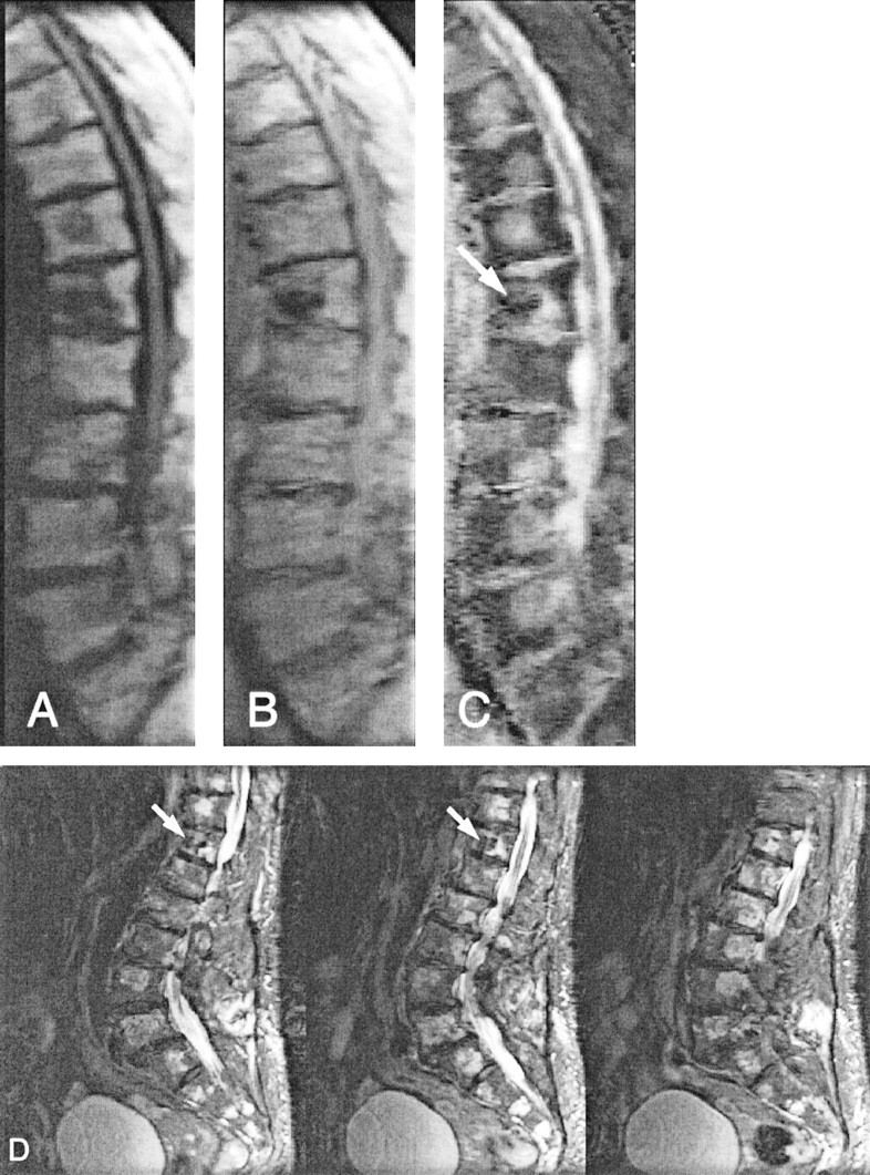 Fig 4.