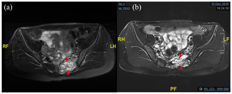 Figure 3.