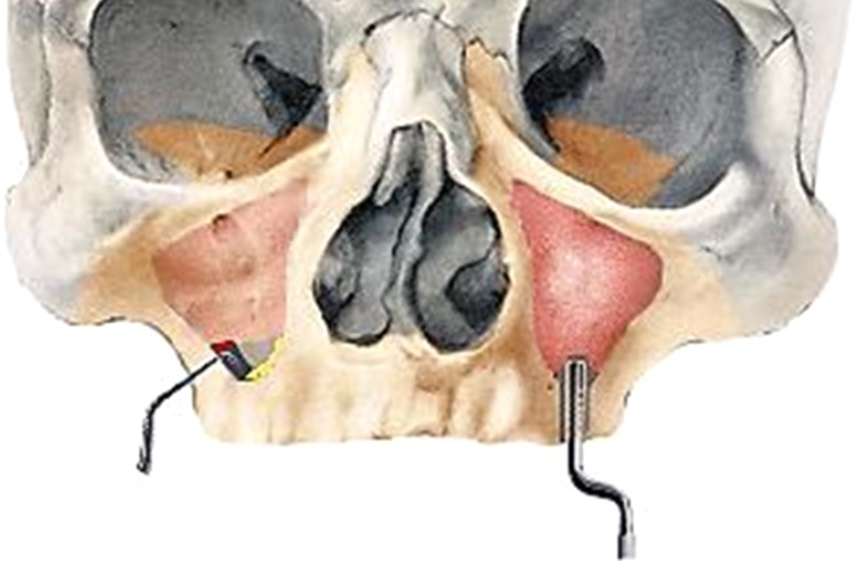 Fig. 2