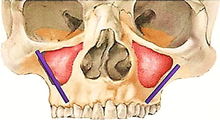 Fig. 3