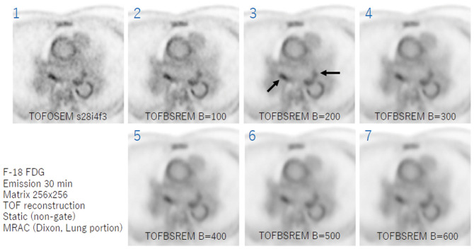 Figure 2.