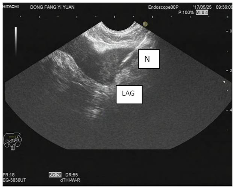 Figure 4.