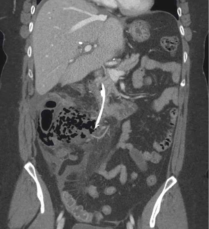 Fig. 2