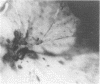 123