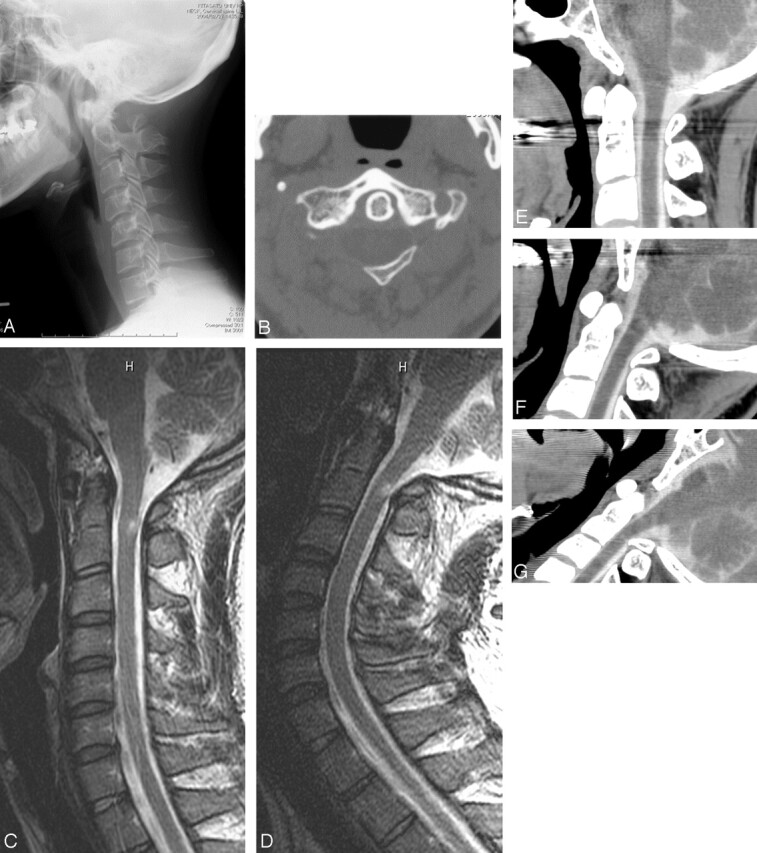 Fig 1.