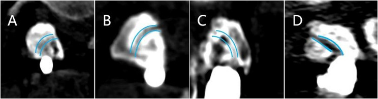 Fig. 4