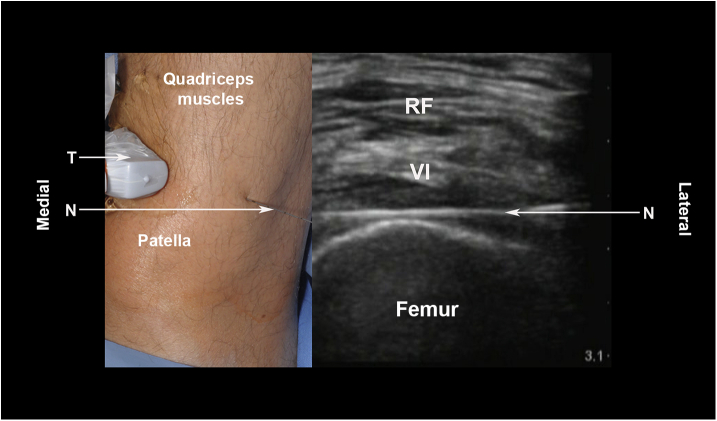 Fig 3