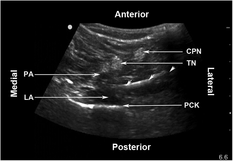 Fig 4