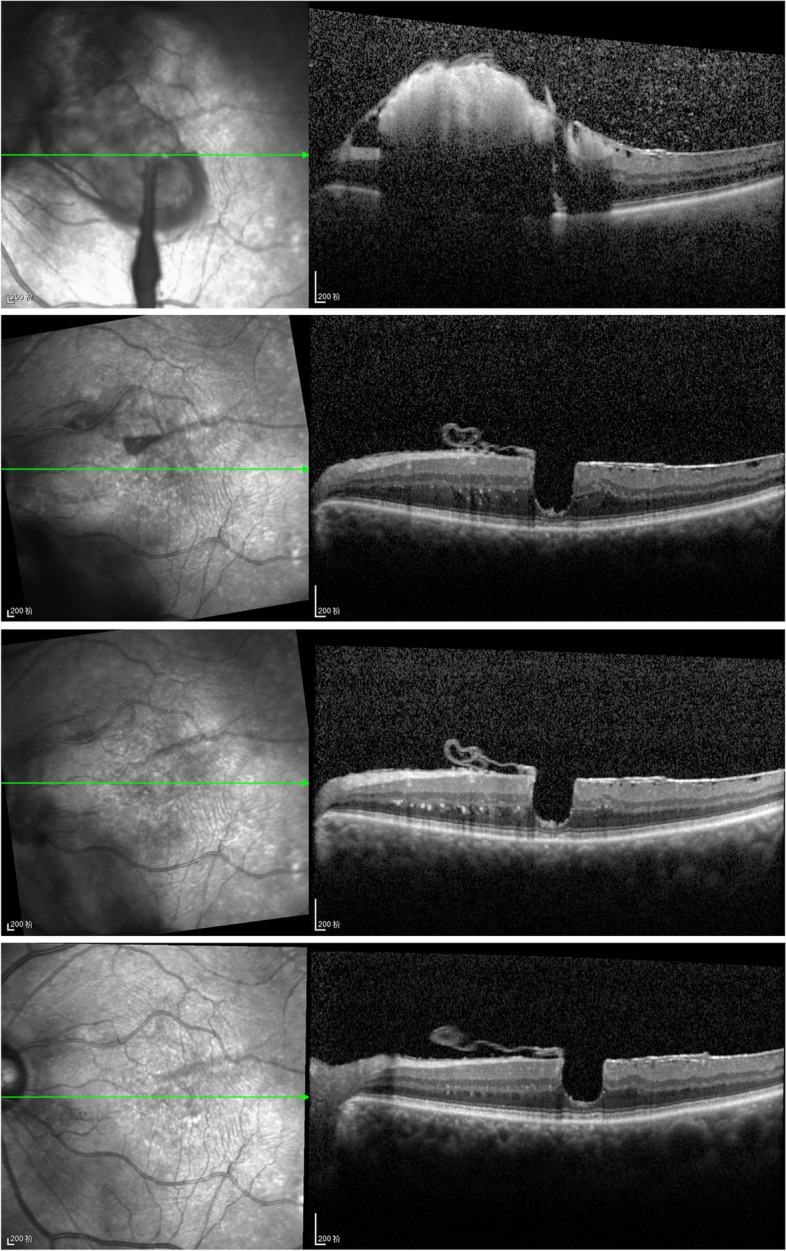 Fig. 4