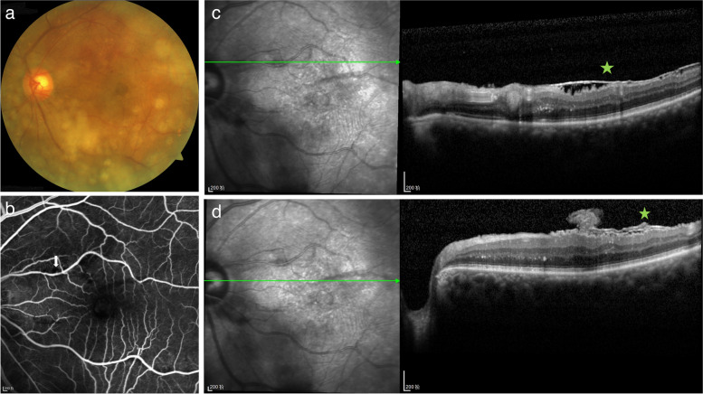 Fig. 3