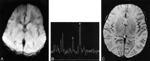 fig 3.