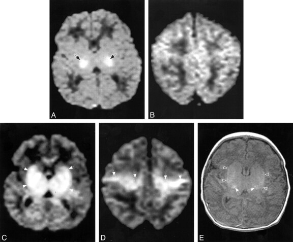 fig 2.