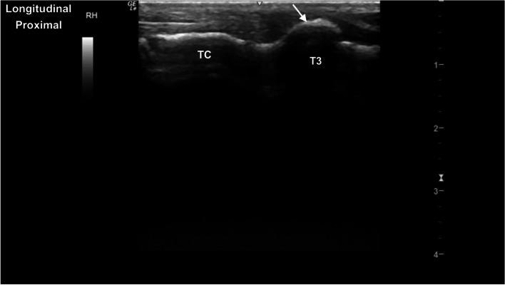 Fig. 19