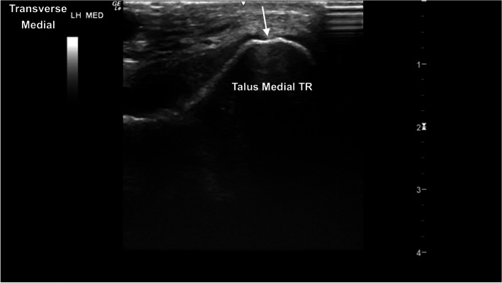 Fig. 17