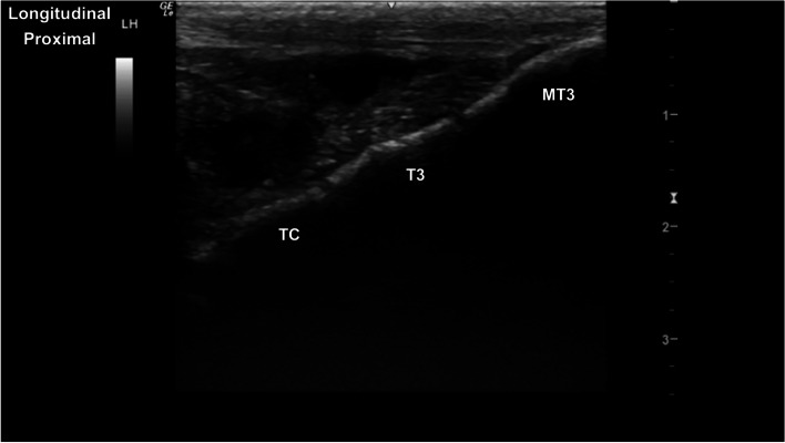 Fig. 18