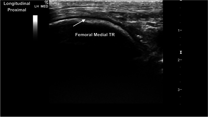 Fig. 14