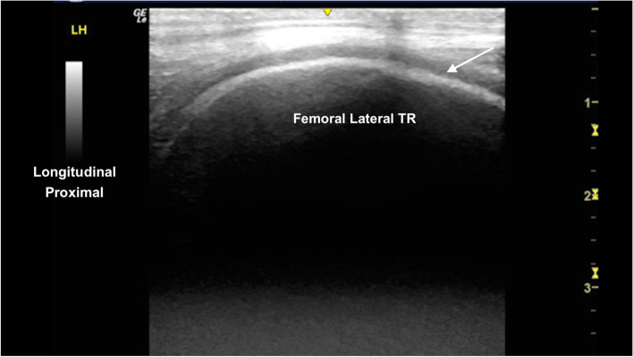 Fig. 12