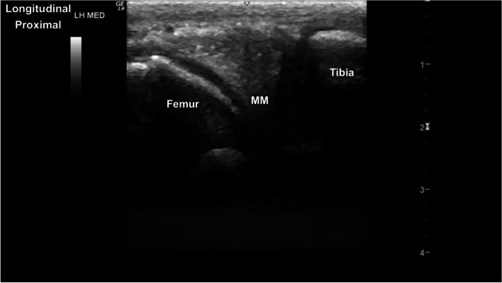 Fig. 15