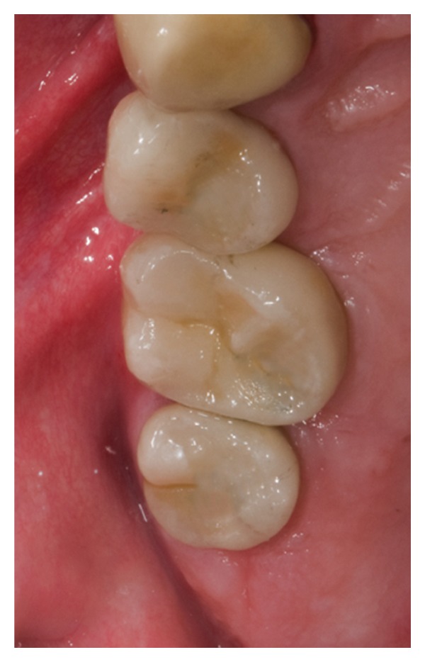 Figure 9