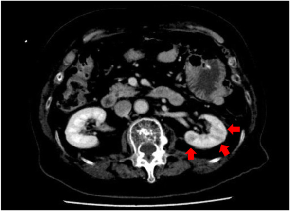 Fig. 2