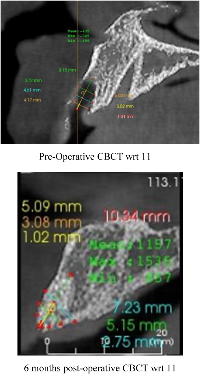 Fig. 4b