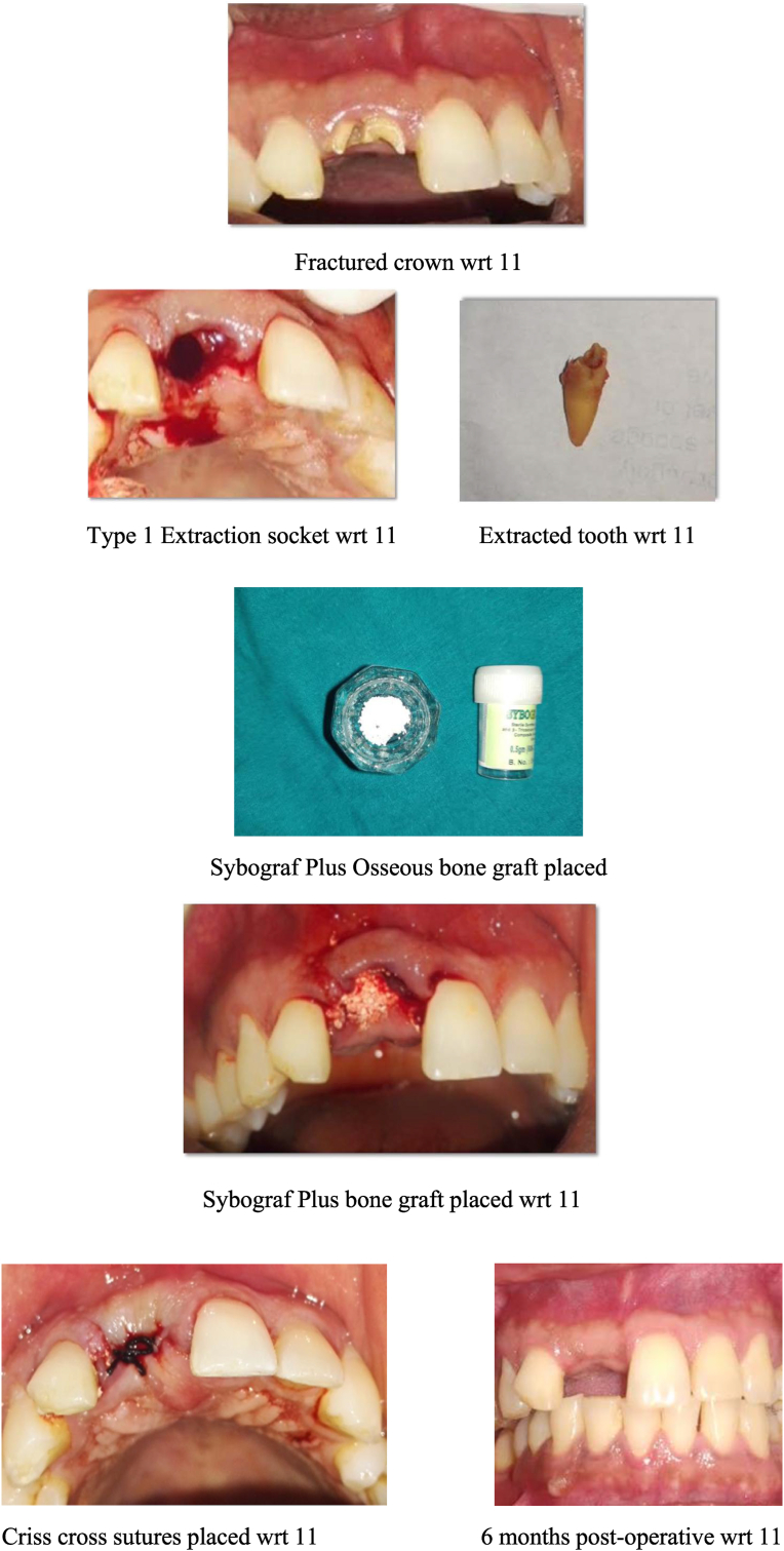 Fig. 4a