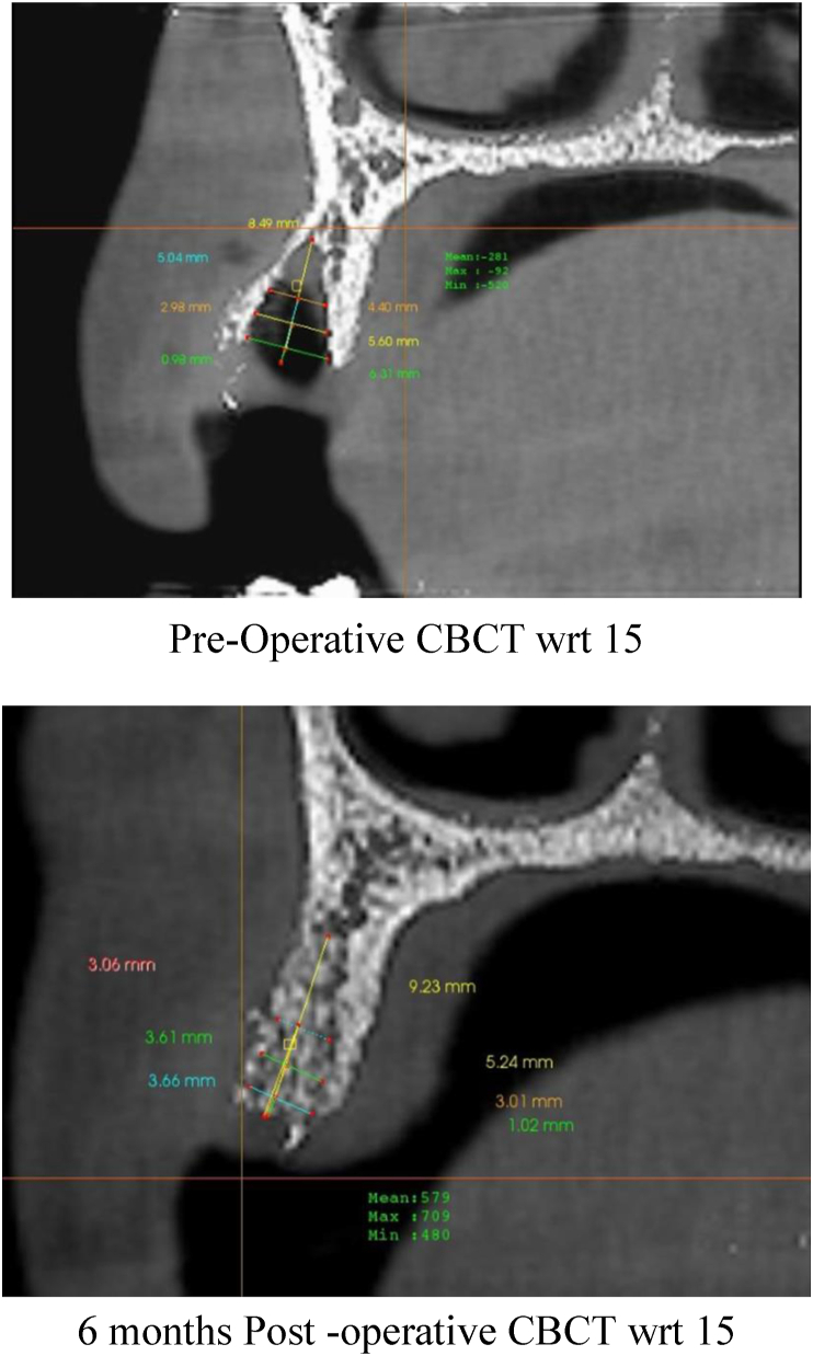 Fig. 3b