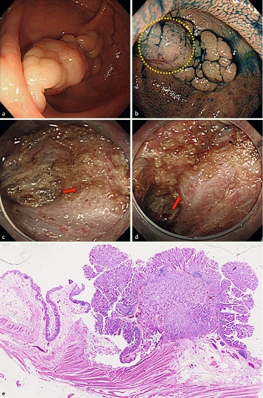 Fig. 2