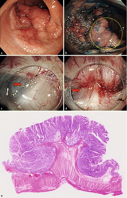 Fig. 1