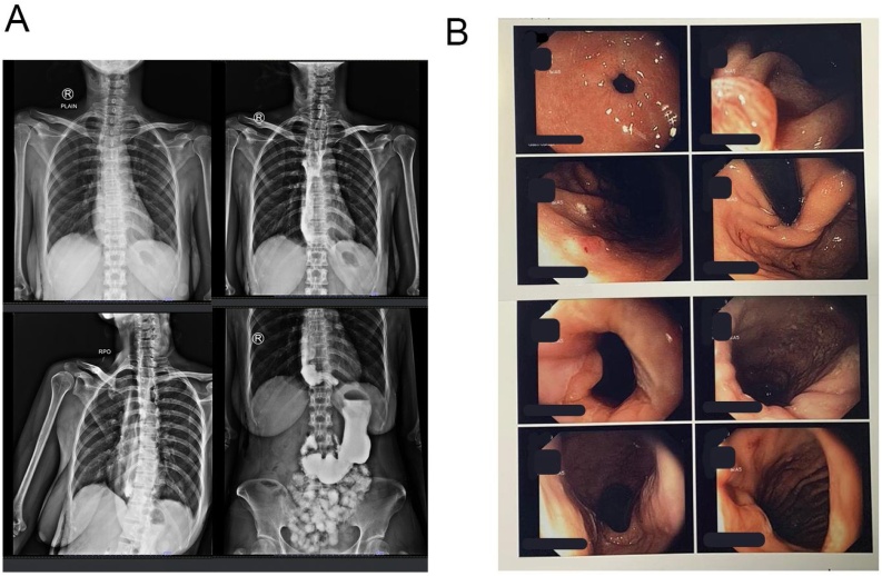 Fig. 5